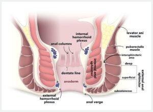 Read more about the article Breaking the Stigma – Understanding Anal Fissure and its Homeopathic Approach