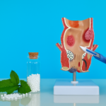 Homeopathy vs Surgery: Which is Better for Treating Fistula?