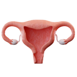 Read more about the article LOOKING FOR A NATURAL CURE FOR PCOD IN DELHI? HERE’S WHERE TO START