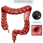 Beat Constipation Naturally with Homeopathy: A Gut-Healing Guide
