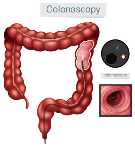 Read more about the article Beat Constipation Naturally with Homeopathy: A Gut-Healing Guide
