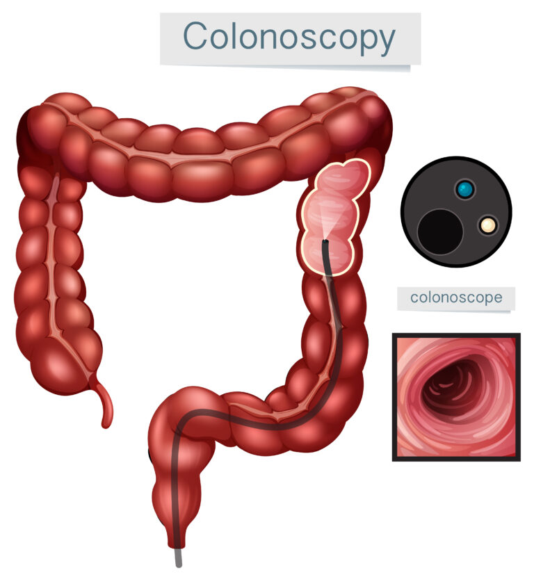 Human Anatomy Colonoscopy