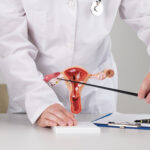 Best Natural Remedies for Piles Without Surgery ?