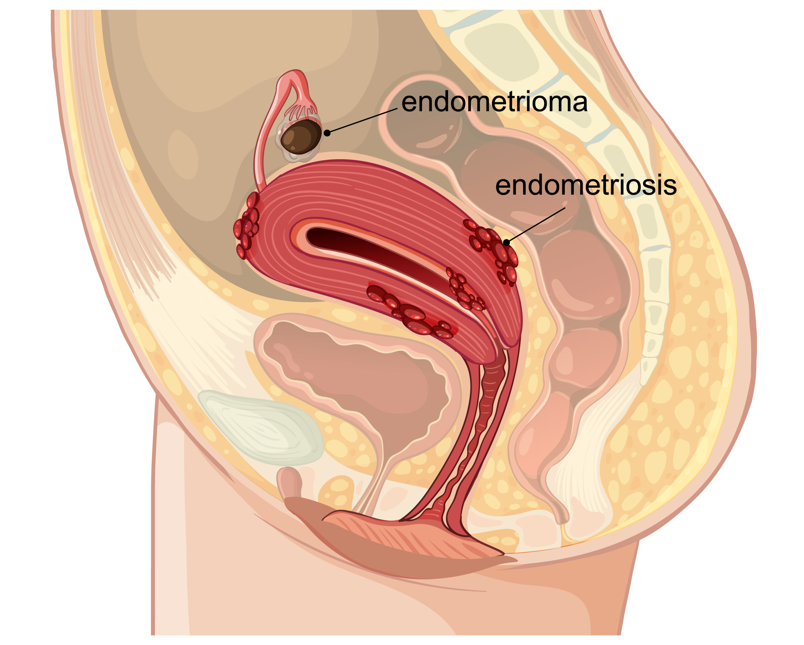 You are currently viewing Top 5 Natural Remedies for Fistula Relief