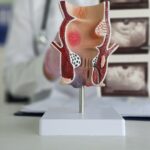 How to Manage Piles at Home: Diet, Lifestyle and Remedies