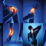 Joint Pain and Arthritis Relief with Natural Homeopathy