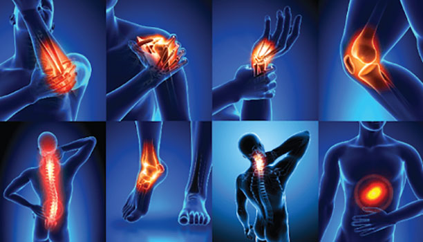 You are currently viewing Joint Pain and Arthritis Relief with Natural Homeopathy
