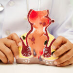 Why Repeated Antibiotics Can Delay Healing in Fistula Patients ?