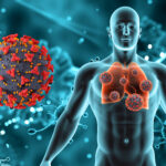 The Link Between Immunity and Chronic Skin, Gut & Respiratory Conditions