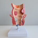 Foods to Eat and Avoid During Piles Treatment